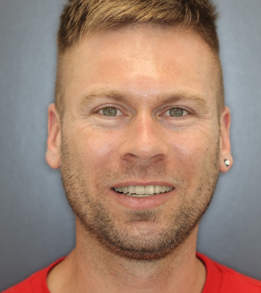 After treatment view 1