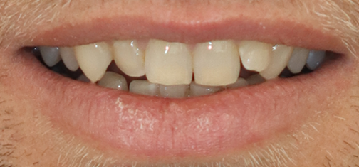 After treatment view 3