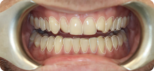 After treatment view 2