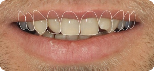 After treatment view 1